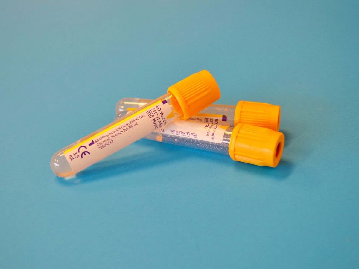 Collection tubes on a blue surface